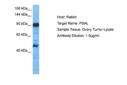 Puromycin-sensitive aminopeptidase/NPEPPS Antibody, Novus Biologicals 100 &mu;L | Buy Online | Novus Biologicals | Fisher Scientific